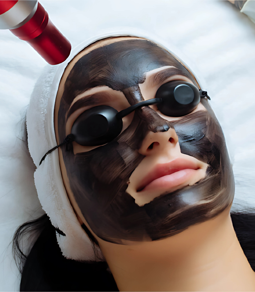 Carbon Facial